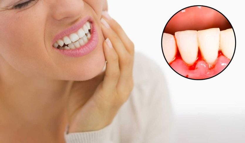 Bleeding-gums-and-loose-teeth-1024x597
